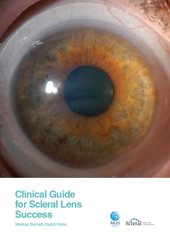Clinical Guide for Scleral Lens Success