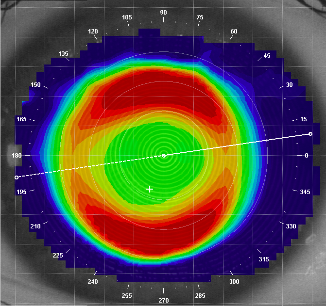 Myopia Management